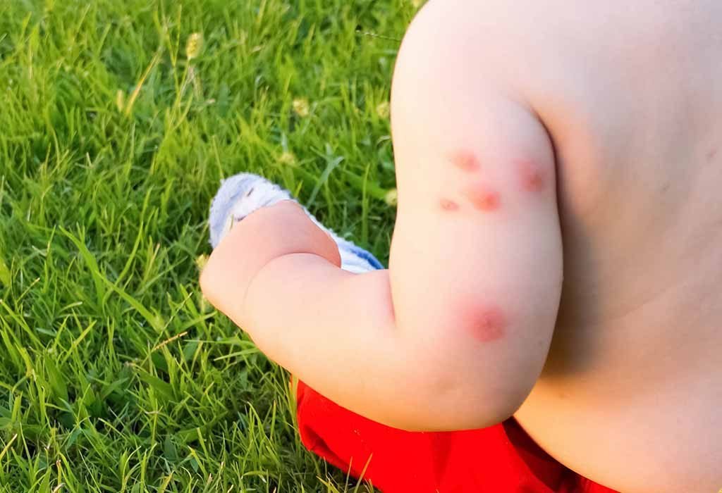 Prevent Baby Bed Bugs